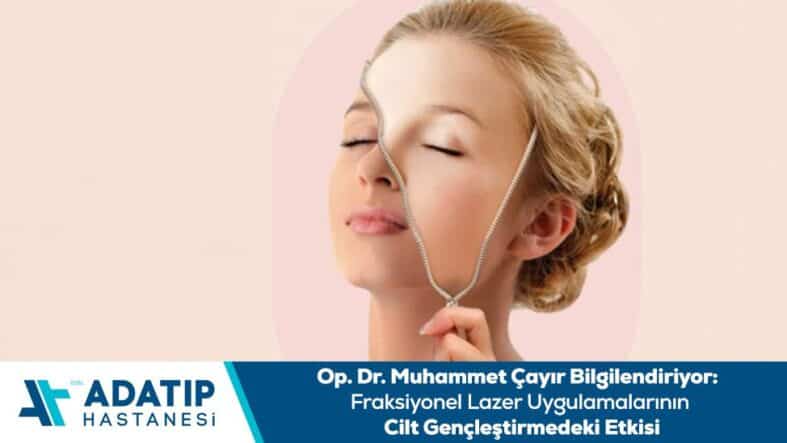 fraksiyonel-lazer-uygulamalarinin-cilt-genclestirmedeki